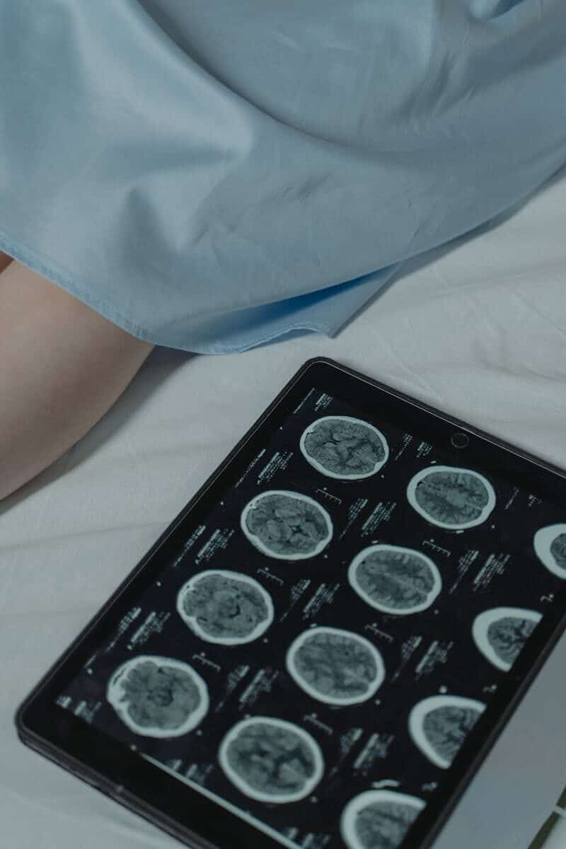 Causes of TBI