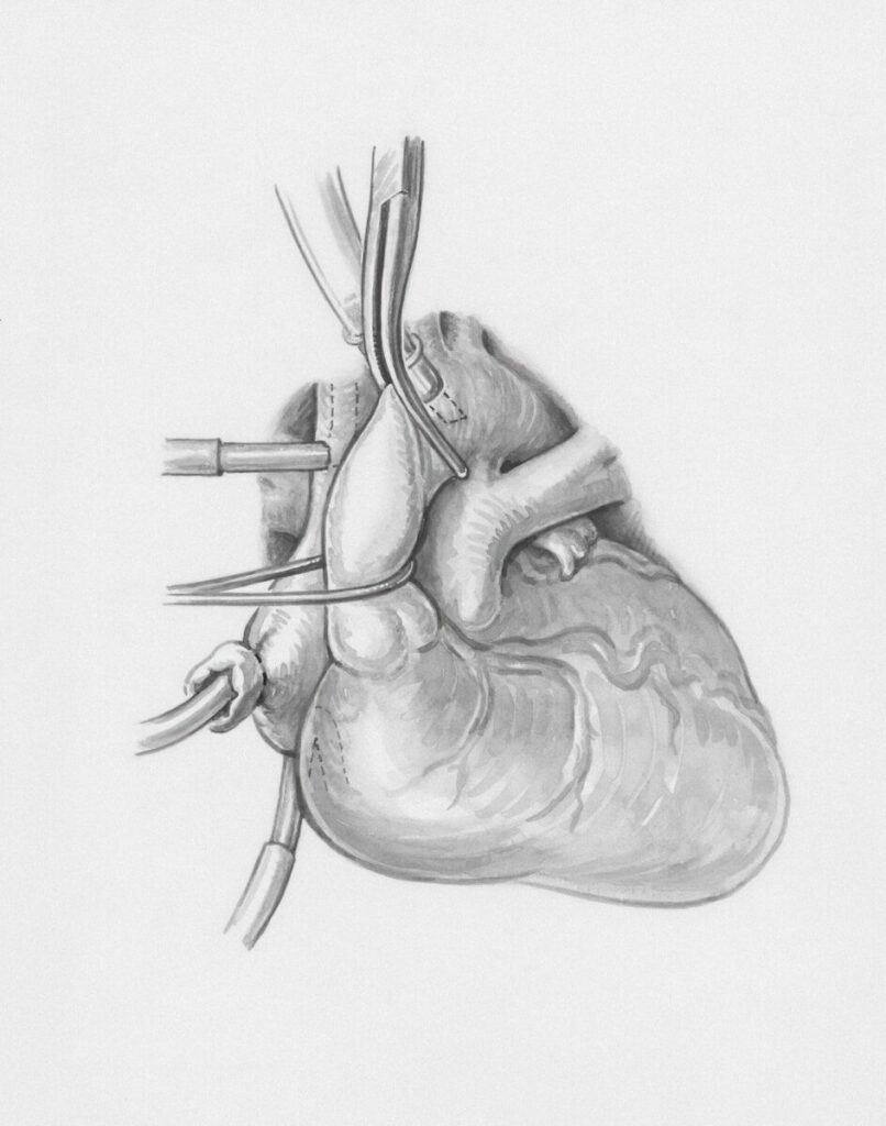 Current image: a drawing of a heart with a vein attached to it